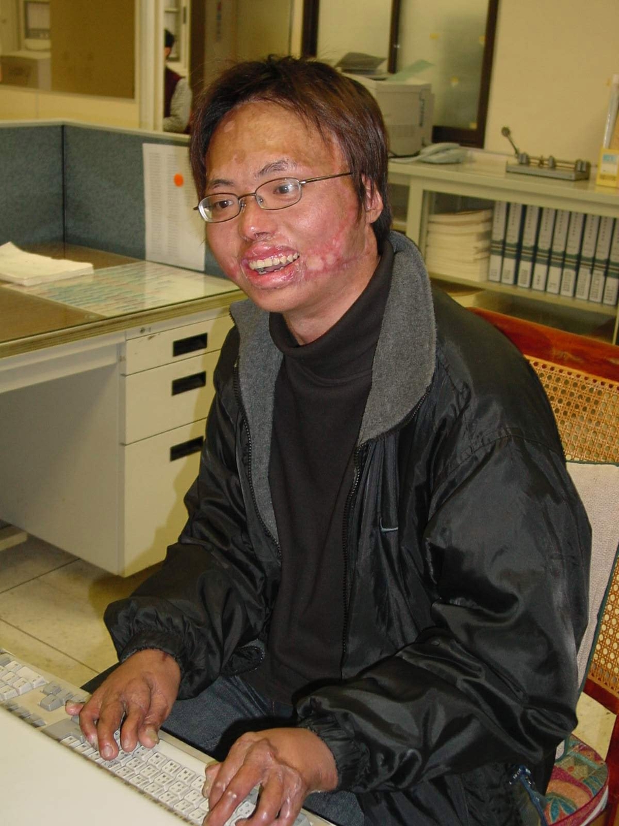 樂觀的吳韋慶認為「上帝關了你這扇門，必定會為你開啟另外一扇窗」。圖片